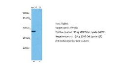 ZFP36L1 Antibody, Novus Biologicals 100 &mu;L | Buy Online | Novus Biologicals | Fisher Scientific